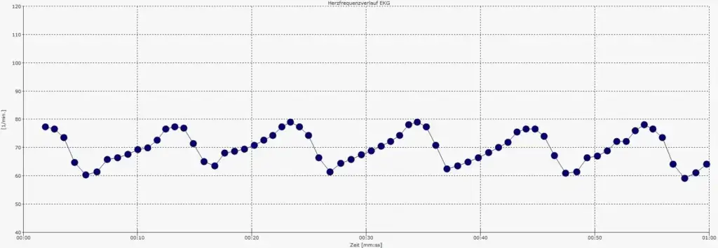 Time series graph showing heart rate (bpm) over 1 minute, with values roughly between 60 and 80 bpm, titled 'Herzfrequenzverlauf EKG' and time on the x-axis labeled 'Zeit [mm:ss]'.
